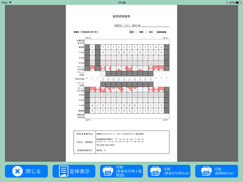 印刷プレビュー